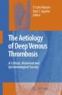 Aetiology Of Deep Venous Thrombosis - Preview