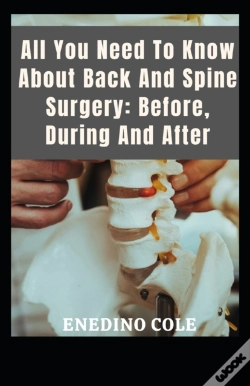 Capa do artigo All You Need To Know About Back And Spine Surgery