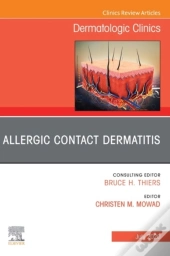 Allergic Contact Dermatitis,An Issue Of Dermatologic Clinics - E-Book