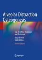 Alveolar Distraction Osteogenesis - Preview