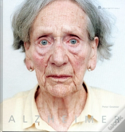 Capa do artigo Alzheimer