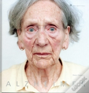 Capa do artigo Alzheimer
