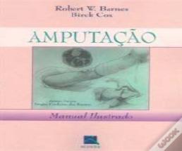 Amputação
