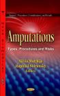 Amputations - Preview