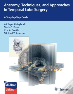 Capa do artigo Anatomy, Techniques, And Approaches In Temporal Lobe Surgery