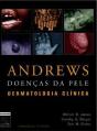 Andrews - Doenças da Pele - Preview