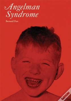 Capa do artigo Angelman Syndrome