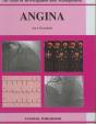 Angina - Preview