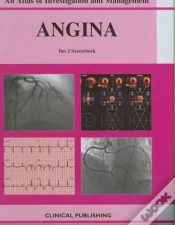 Capa do artigo Angina