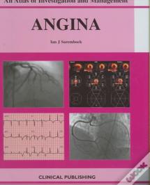 Angina