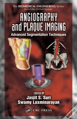 Capa do artigo Angiography And Plaque Imaging