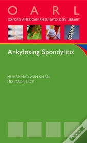 Ankylosing Spondylitis