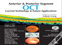 Anterior & Posterior Segment Oct: Current Technology & Future Applications