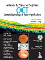 Anterior & Posterior Segment Oct: Current Technology & Future Applications - Preview