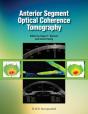 Anterior Segment Optical Coherence Tomography - Preview
