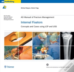 Capa do artigo Ao Manual Of Fracture Management: Internal Fixators