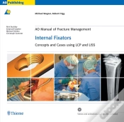 Capa do artigo Ao Manual Of Fracture Management: Internal Fixators