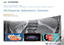 Aospine Masters Series Volume 2: Primary Spinal Tumors