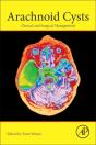 Arachnoid Cysts - Preview