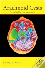 Capa do artigo Arachnoid Cysts