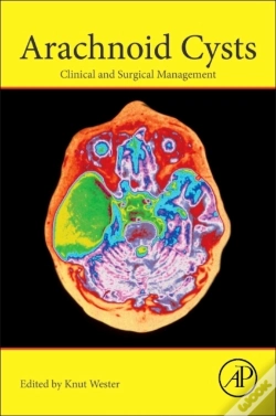 Capa do artigo Arachnoid Cysts