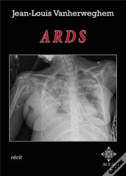 Capa do artigo Ards