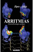 Arritmias. Electrofisiologia Cardiaca