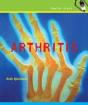 Arthritis - Preview