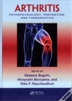 Capa do artigo Arthritis
