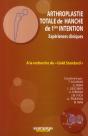 Arthroplastie Totale De Hanche De 1ère Intention ; Expériences Cliniques - Preview