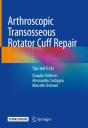 Arthroscopic Transosseous Rotator Cuff Repair - Preview