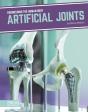 Artificial Joints - Preview