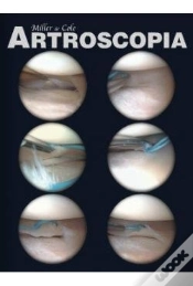 Capa do artigo Artroscopia Flexilibro
