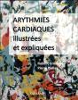 Arythmies Cardiaques Illustrees Et Expliquees - Preview