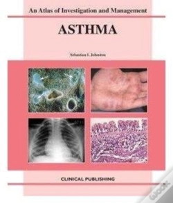 Capa do artigo Asthma