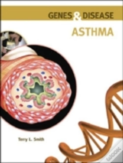 Capa do artigo Asthma