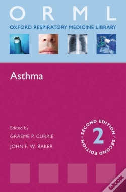Capa do artigo Asthma