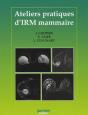 Ateliers Pratiques D'Irm Mammaire - Preview