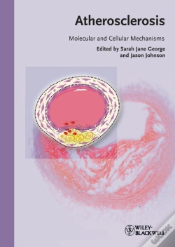 Capa do artigo Atherosclerosis