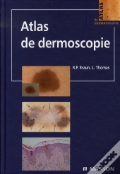 Atlas De Dermoscopie