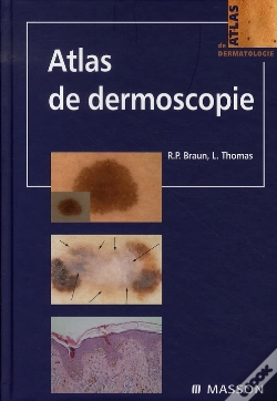 Capa do artigo Atlas De Dermoscopie