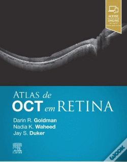 Capa do artigo Atlas de OCT em Retina