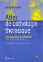 Atlas De Pathologie Thoracique - Preview