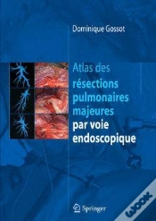 Capa do artigo Atlas Des Résections Pulmonaires Majeures Par Voie Endoscopique