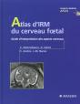 Atlas D'Irm Du Cerveau Foetal ; Guide D'Interpretation Des Aspects Normaux - Preview