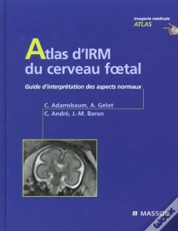 Capa do artigo Atlas D'Irm Du Cerveau Foetal ; Guide D'Interpretation Des Aspects Normaux