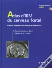 Capa do artigo Atlas D