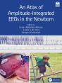 Atlas Of Amplitude-Integrated Eegs In The Newborn - Preview
