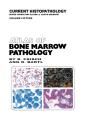 Atlas Of Bone Marrow Pathology - Preview