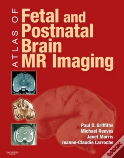 Capa do artigo Atlas Of Fetal And Postnatal Brain Mr